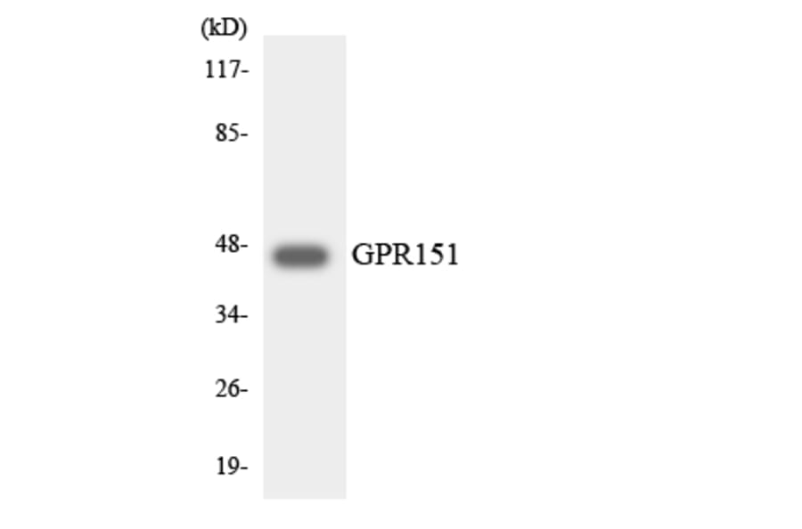Western Blot - Anti-GPR151 Antibody (R12-2833) - Antibodies.com