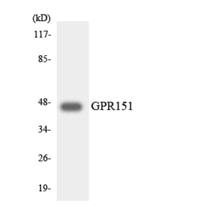 Western Blot - Anti-GPR151 Antibody (R12-2833) - Antibodies.com