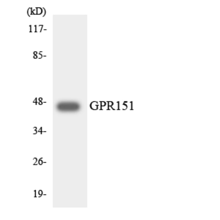 Western Blot - Anti-GPR151 Antibody (R12-2833) - Antibodies.com