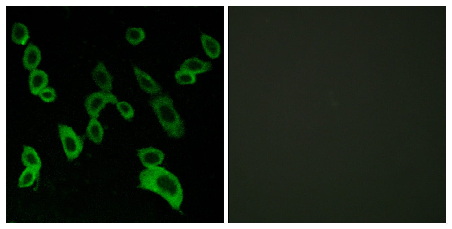 Immunofluorescence analysis of LOVO cells using Anti-GPR139 Antibody. The right hand panel represents a negative control, where the antibody was pre-incubated with the immunising peptide.