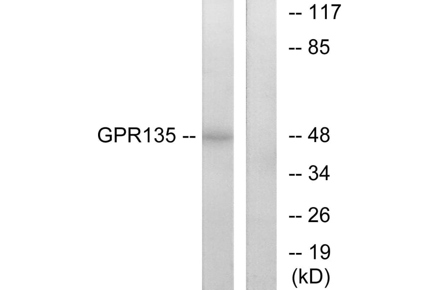 Western Blot - Anti-GPR135 Antibody (G293) - Antibodies.com
