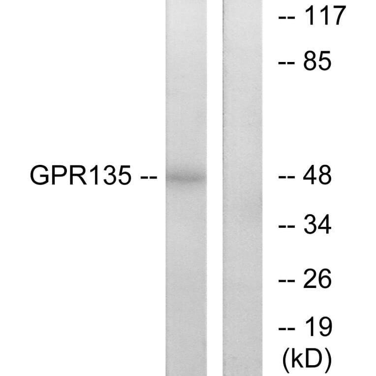 Western Blot - Anti-GPR135 Antibody (G293) - Antibodies.com