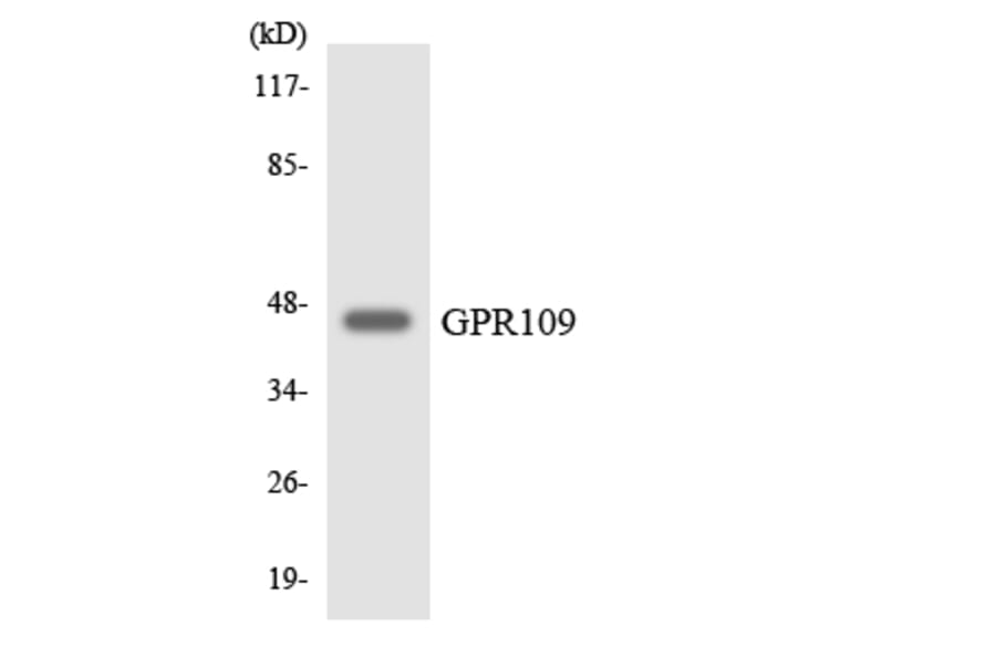 Western Blot - Anti-GPR109 Antibody (R12-2824) - Antibodies.com