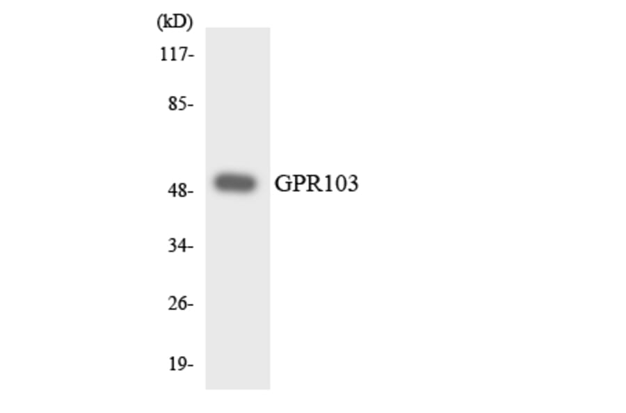 Western Blot - Anti-GPR103 Antibody (R12-2821) - Antibodies.com