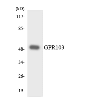 Western Blot - Anti-GPR103 Antibody (R12-2821) - Antibodies.com