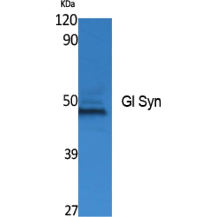 Western Blot - Anti-Gl Syn Antibody (R12-2165) - Antibodies.com