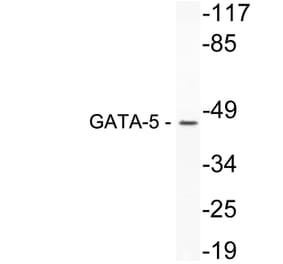 Western Blot - Anti-GATA-5 Antibody (R12-2154) - Antibodies.com