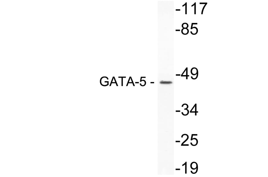 Western Blot - Anti-GATA-5 Antibody (R12-2154) - Antibodies.com