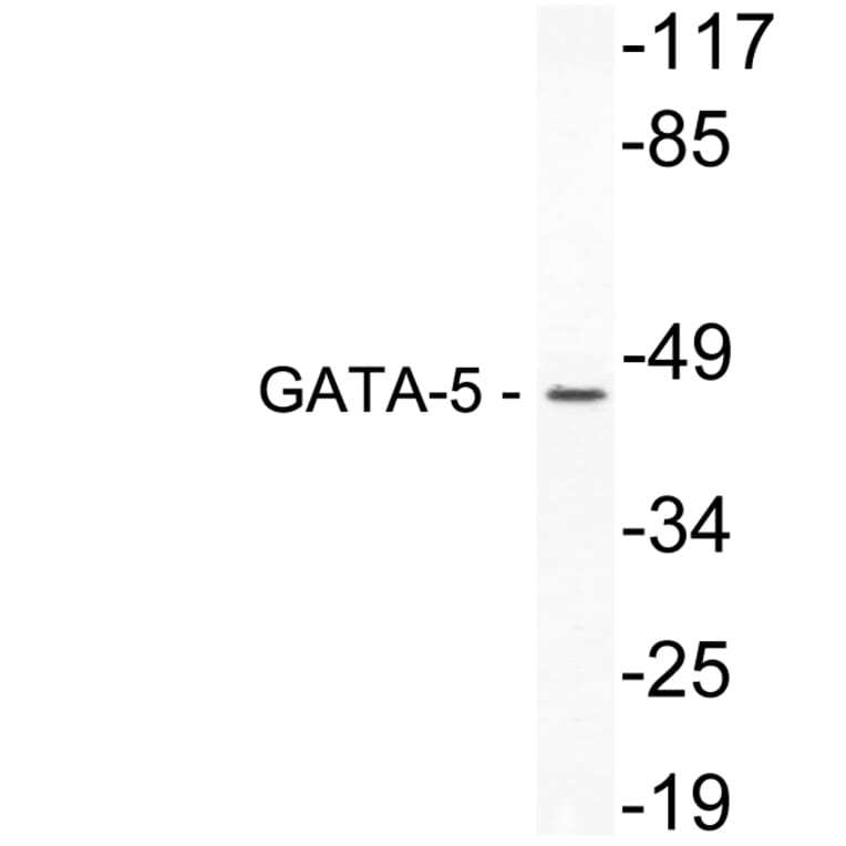 Western Blot - Anti-GATA-5 Antibody (R12-2154) - Antibodies.com