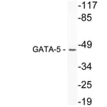 Western Blot - Anti-GATA-5 Antibody (R12-2154) - Antibodies.com