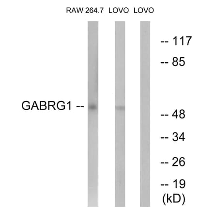 Western Blot - Anti-GABRG1 Antibody (C15858) - Antibodies.com