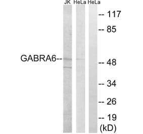 Western Blot - Anti-GABRA6 Antibody (C15852) - Antibodies.com
