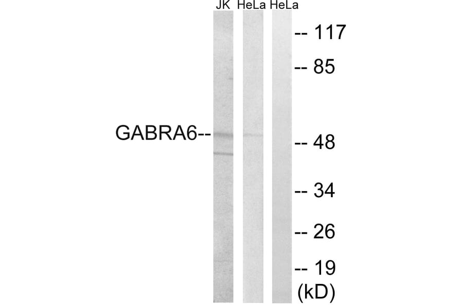Western Blot - Anti-GABRA6 Antibody (C15852) - Antibodies.com