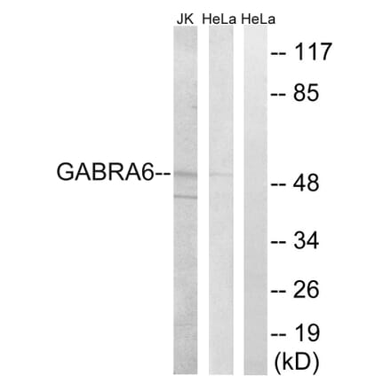 Western Blot - Anti-GABRA6 Antibody (C15852) - Antibodies.com