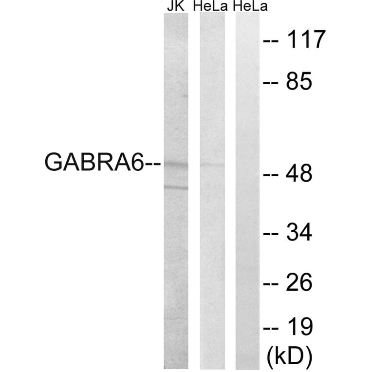 Western Blot - Anti-GABRA6 Antibody (C15852) - Antibodies.com