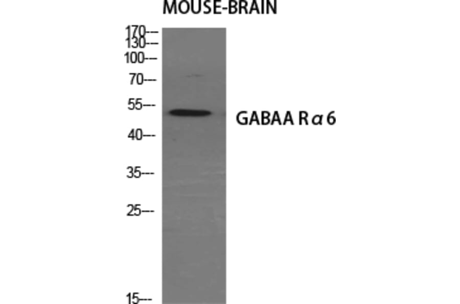 Western Blot - Anti-GABRA6 Antibody (C15852) - Antibodies.com