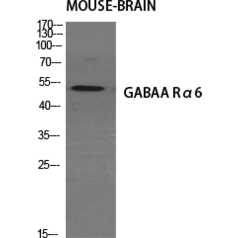 Western Blot - Anti-GABRA6 Antibody (C15852) - Antibodies.com
