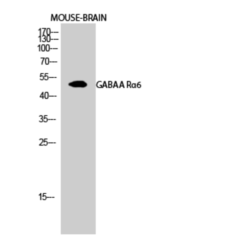 Western Blot - Anti-GABRA6 Antibody (C15852) - Antibodies.com
