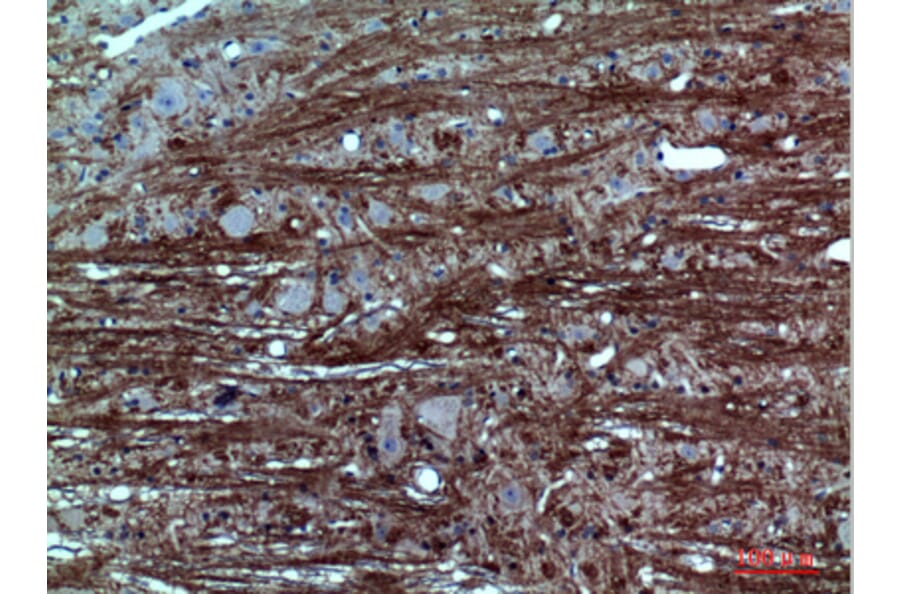 Immunohistochemistry - Anti-GABRA1 Antibody (C30223) - Antibodies.com