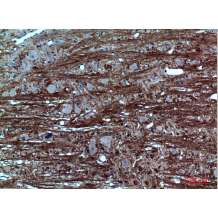 Immunohistochemistry - Anti-GABRA1 Antibody (C30223) - Antibodies.com
