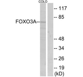 Western Blot - Anti-FKHRL1 Antibody (B7087) - Antibodies.com