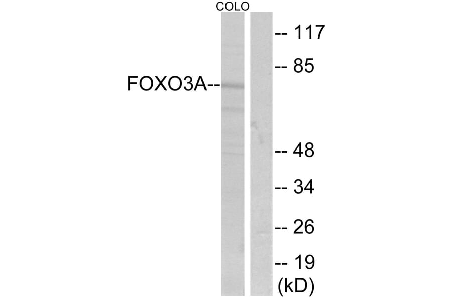Western Blot - Anti-FKHRL1 Antibody (B7087) - Antibodies.com
