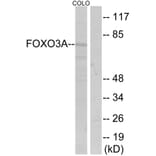 Western Blot - Anti-FKHRL1 Antibody (B7087) - Antibodies.com