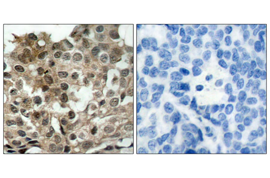 Immunohistochemistry - Anti-FKHRL1 Antibody (B7087) - Antibodies.com
