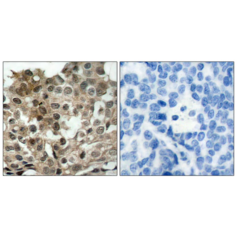 Immunohistochemistry - Anti-FKHRL1 Antibody (B7087) - Antibodies.com