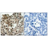 Immunohistochemistry - Anti-FKHRL1 Antibody (B7087) - Antibodies.com