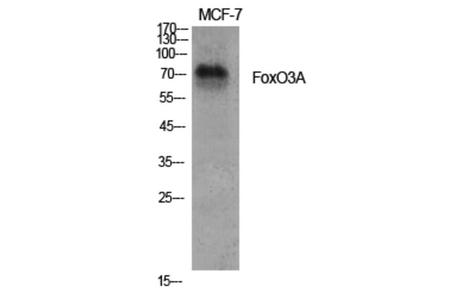 Western Blot - Anti-FKHRL1 Antibody (B7087) - Antibodies.com