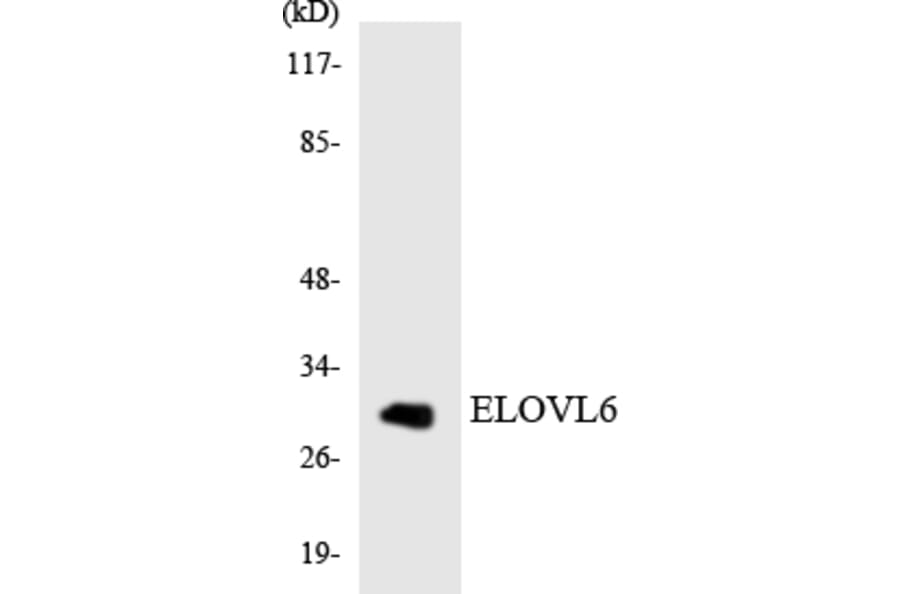 Western Blot - Anti-ELOVL6 Antibody (R12-2746) - Antibodies.com