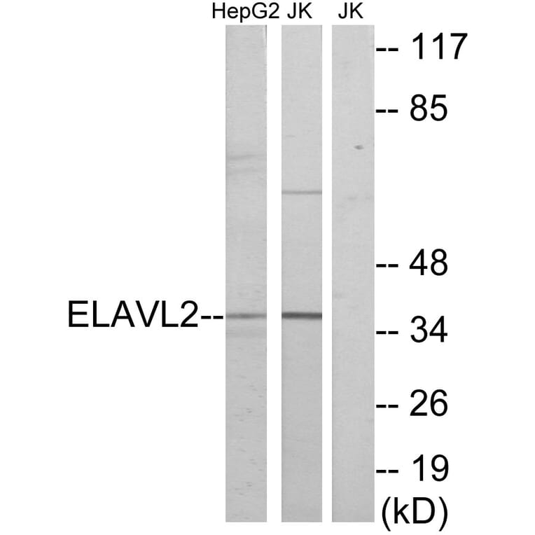 Western Blot - Anti-ELAVL2 Antibody (C10931) - Antibodies.com