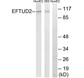 Western Blot - Anti-EFTUD2 Antibody (C14001) - Antibodies.com