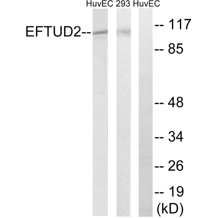 Western Blot - Anti-EFTUD2 Antibody (C14001) - Antibodies.com
