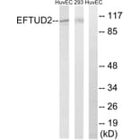 Western Blot - Anti-EFTUD2 Antibody (C14001) - Antibodies.com