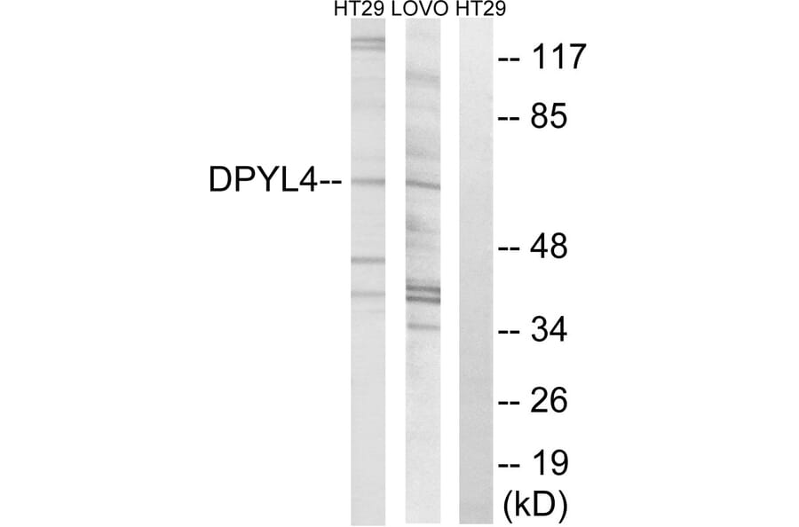 Western Blot - Anti-DPYSL4 Antibody (C15357) - Antibodies.com