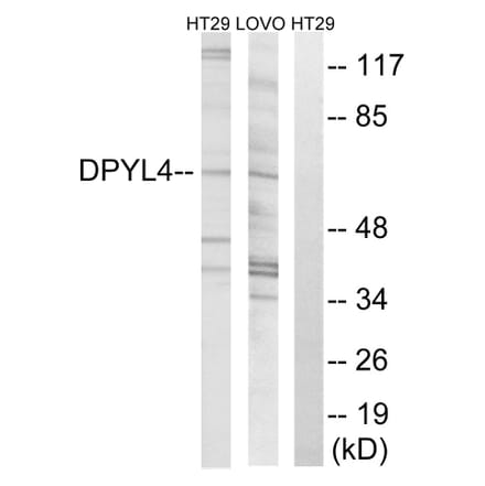 Western Blot - Anti-DPYSL4 Antibody (C15357) - Antibodies.com