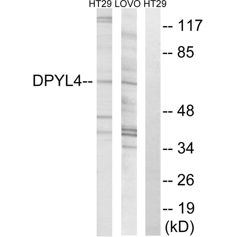 Western Blot - Anti-DPYSL4 Antibody (C15357) - Antibodies.com