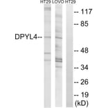 Western Blot - Anti-DPYSL4 Antibody (C15357) - Antibodies.com