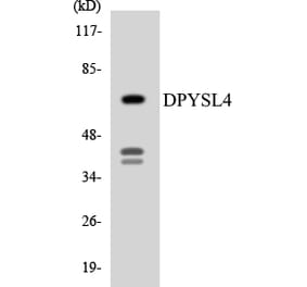Western Blot - Anti-DPYSL4 Antibody (R12-2712) - Antibodies.com