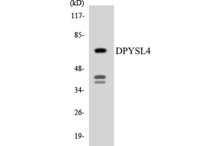 Western Blot - Anti-DPYSL4 Antibody (R12-2712) - Antibodies.com