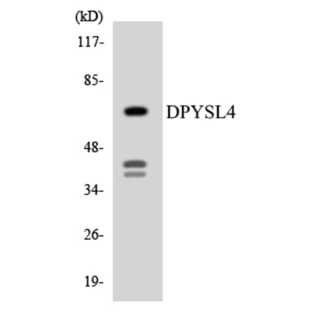 Western Blot - Anti-DPYSL4 Antibody (R12-2712) - Antibodies.com