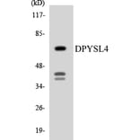 Western Blot - Anti-DPYSL4 Antibody (R12-2712) - Antibodies.com