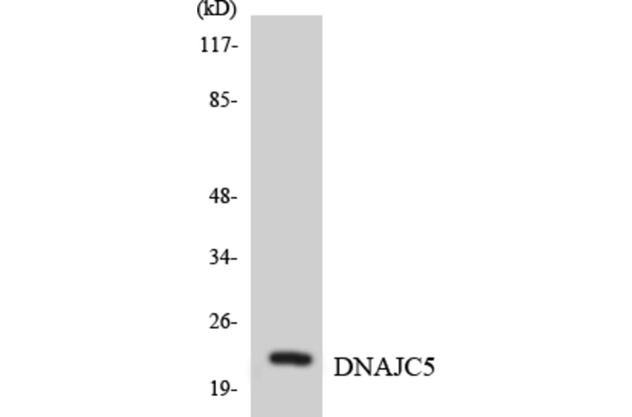 Western Blot - Anti-DNAJC5 Antibody (R12-2707) - Antibodies.com
