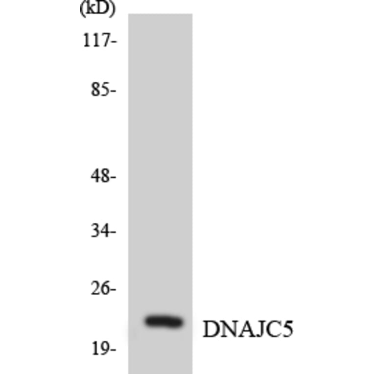 Western Blot - Anti-DNAJC5 Antibody (R12-2707) - Antibodies.com