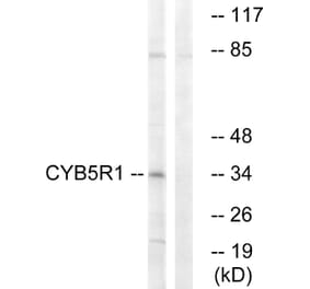 Western Blot - Anti-CYB5R1 Antibody (C16851) - Antibodies.com