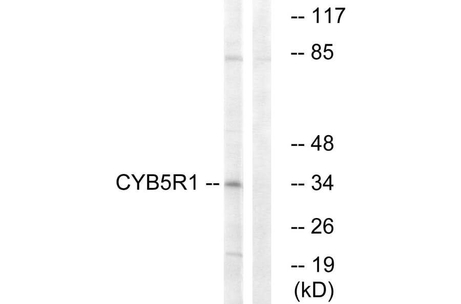 Western Blot - Anti-CYB5R1 Antibody (C16851) - Antibodies.com