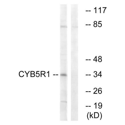 Western Blot - Anti-CYB5R1 Antibody (C16851) - Antibodies.com