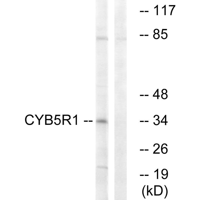 Western Blot - Anti-CYB5R1 Antibody (C16851) - Antibodies.com